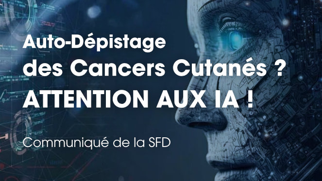 Attention aux IA dans l'auto dépistage des cancers cutanés